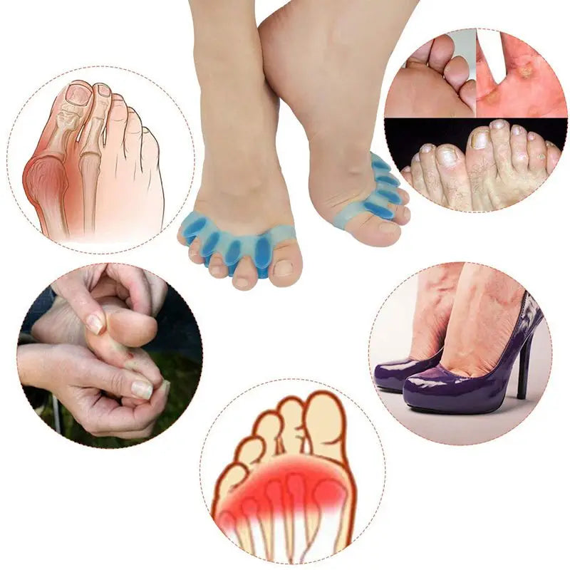 Protective Toes Separator Suitable Bunion Corrector Material Soft Gel Straightener Spacers Stretcher